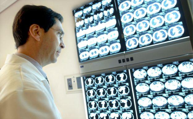 Los médicos apuntan a la importancia de la prevención para dar con la enfermedad en su etapa inicial./AP