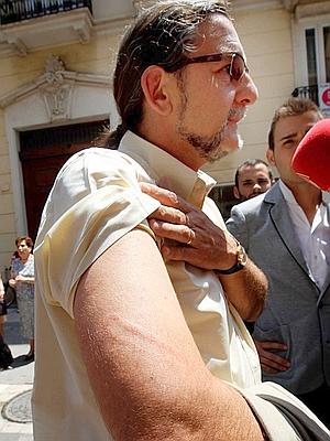 Juan Ponce, diputado del grupo Compromís, muestra la marca en su brazo de un porrazo durante la carga policial contra los "indignados" del movimiento 15-M. / EFE/