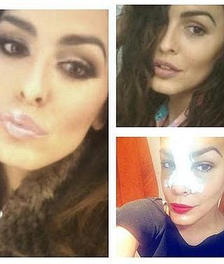 Amor Romeira Gh 9 Pasa Por Quirofano Para Operarse La Nariz Las Provincias